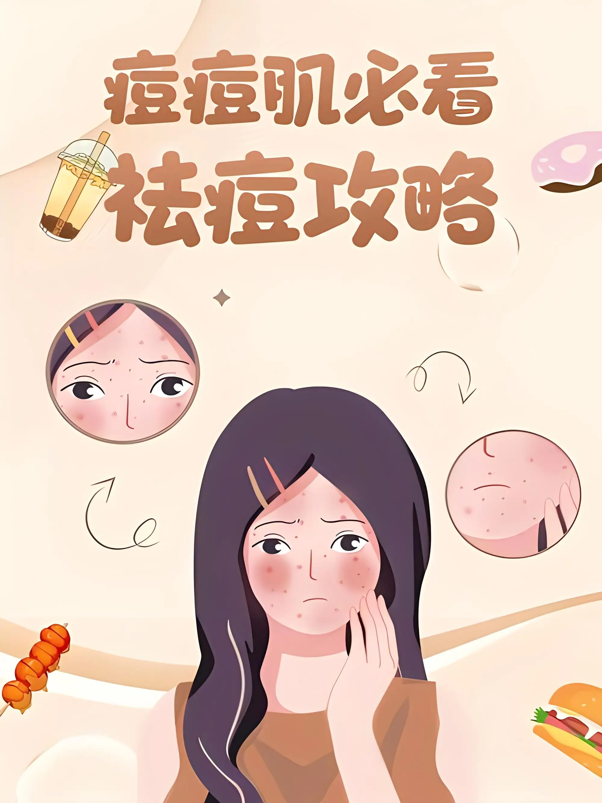 祛痘必看攻略