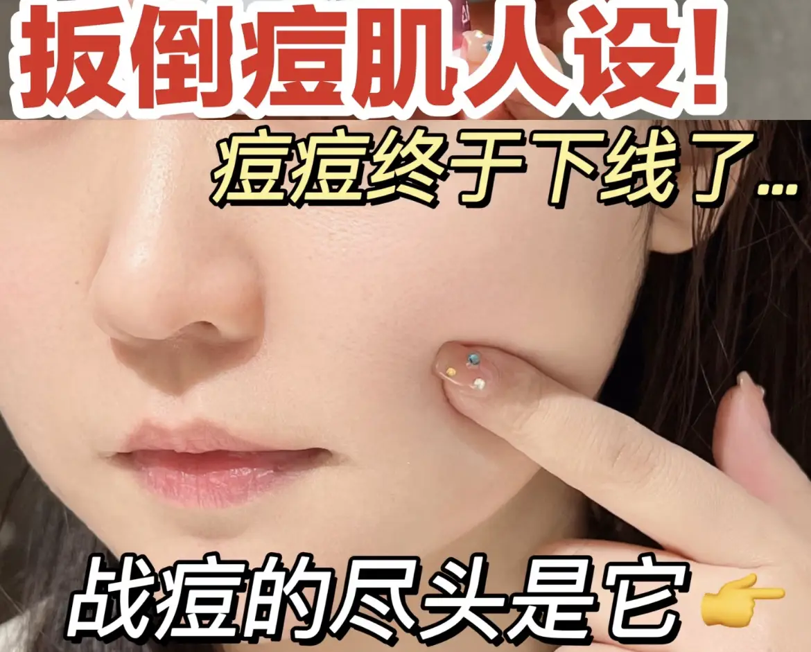 战痘反馈